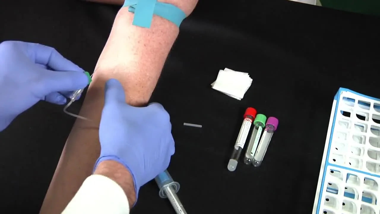 Inserting butterfly needle