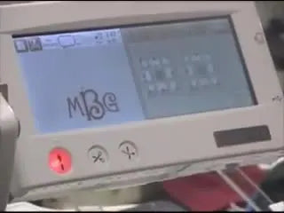 A close-up shows the needle being manually lowered near the inner corner of a yellow clamp window to confirm safe clearance before stitching.